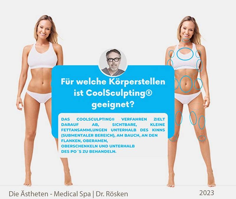 Zonen für Kryolipolyse mit Coolsculpting - Dr. Rösken