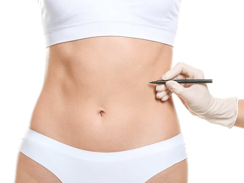 Fettabsaugung Bauch - Info Dr. Rösken Fettabsaugung Bauch - Info Dr. Rösken