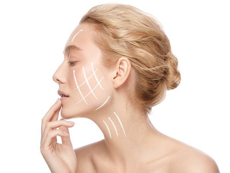 Mehr erfahren über Fadenlifting in München